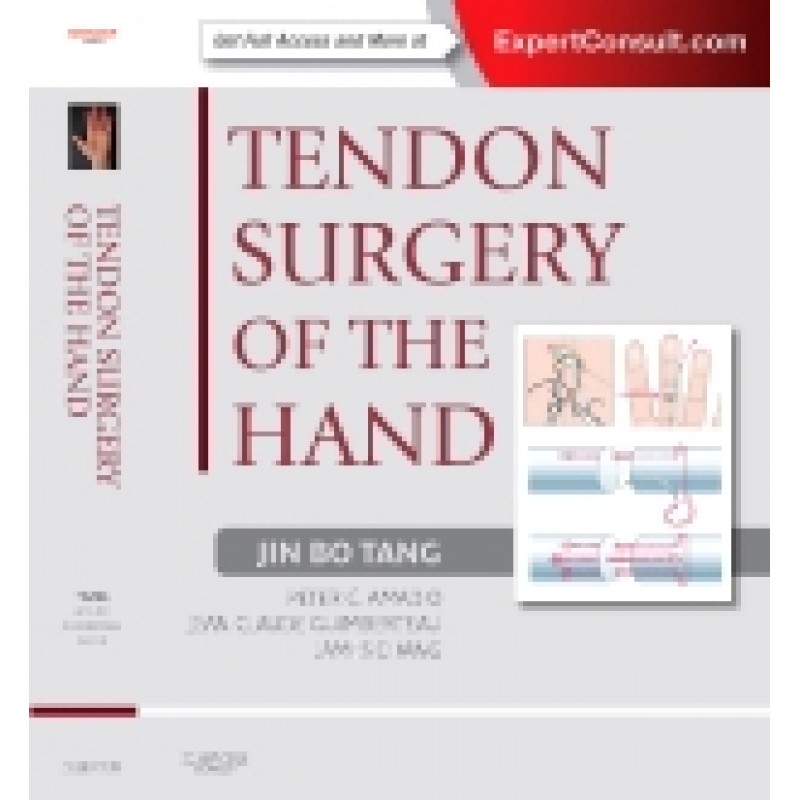 Tendon Surgery of the Hand - Expert Consult - Online and Print